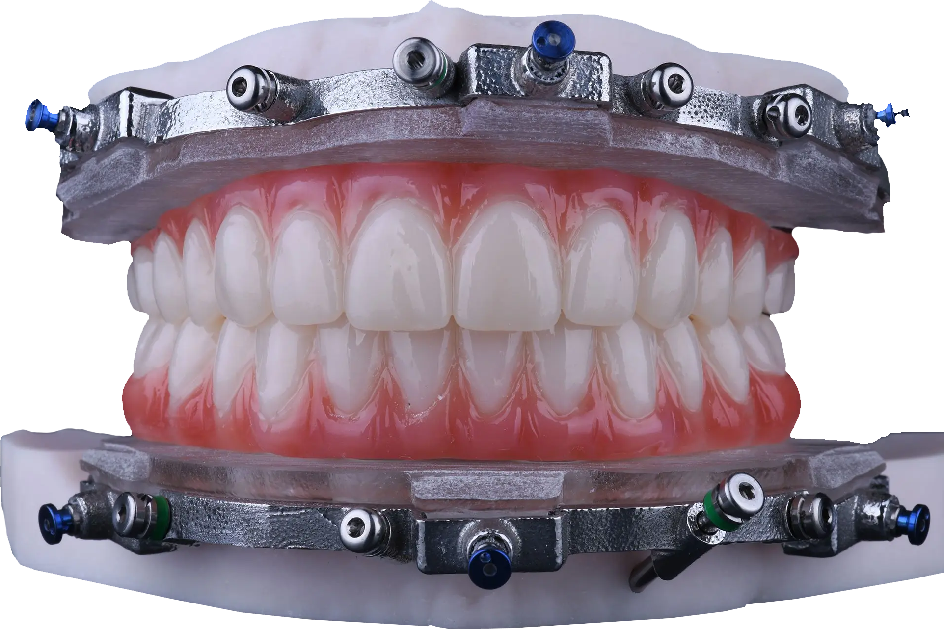Surgical Guides